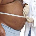 Связь ожирения и рака предстательной железы