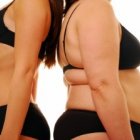 Степени ожирения, как лечить ожирение