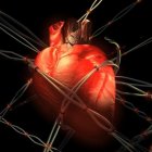 Алкоголь и болезни сердца: лидируют аритмии