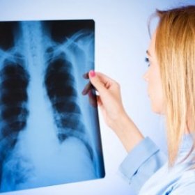 Алкоголизм «помогает» лёгким болеть