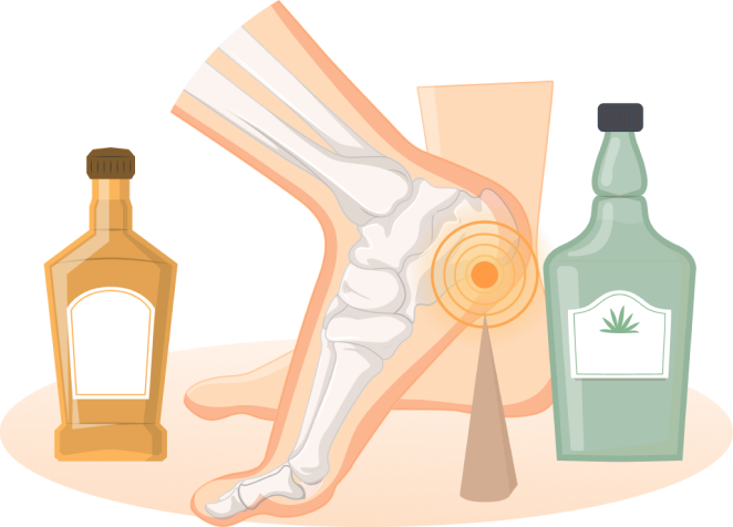 алкогольная миопатия